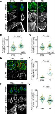 C9orf72-Derived Proline:Arginine Poly-Dipeptides Modulate Cytoskeleton and Mechanical Stress Response